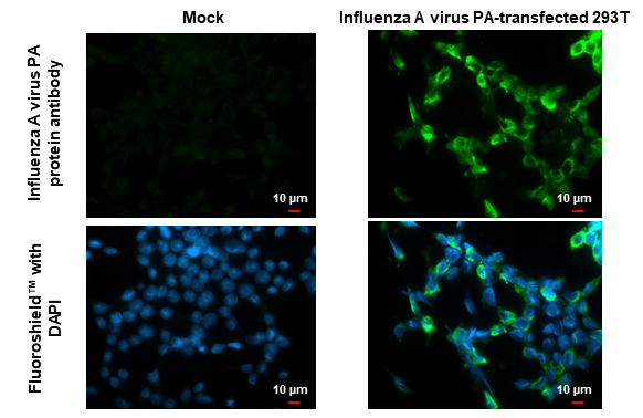 Anti-Influenza A virus PA protein antibody (GTX118991) | GeneTex
